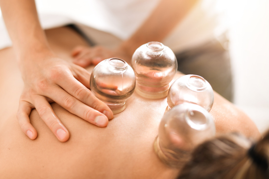 woman therapist hands giving cupping treatment on back
