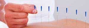 dry needle therapy las vegas